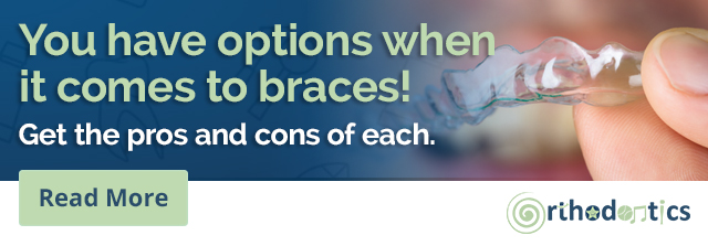 Types of Braces, Parma, OH