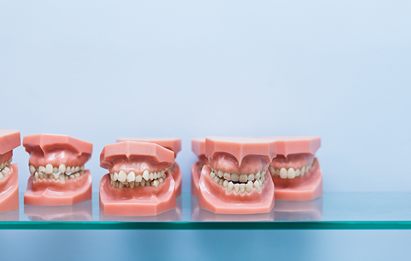 A row of model teeth showing off different types of malocclusion