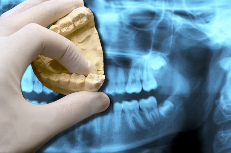 An X-Ray as a dentist explains what an orthodontist is