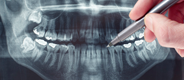 Dentofacial Orthopedics