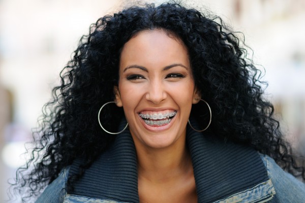 Braces Myths Debunked