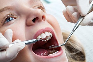 The History of Tooth Crowding | Dr. Andy