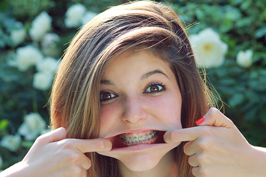 Teenage girl enjoying the summer while making a funny expression to show her braces.