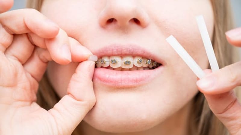 A woman wearing braces learning how to use orthodontic wax