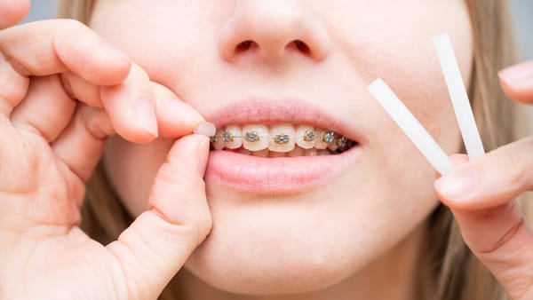A woman wearing braces learning how to use orthodontic wax