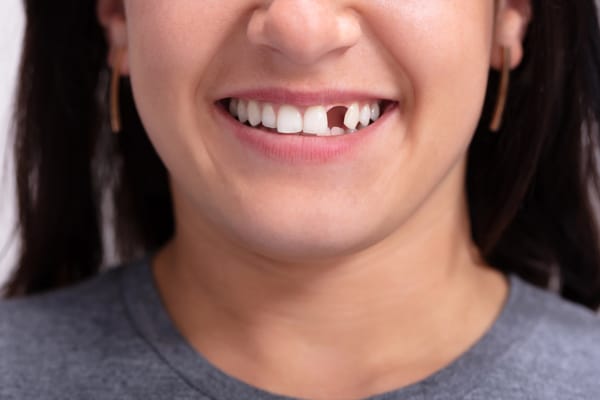 A woman with a missing tooth looking to get braces