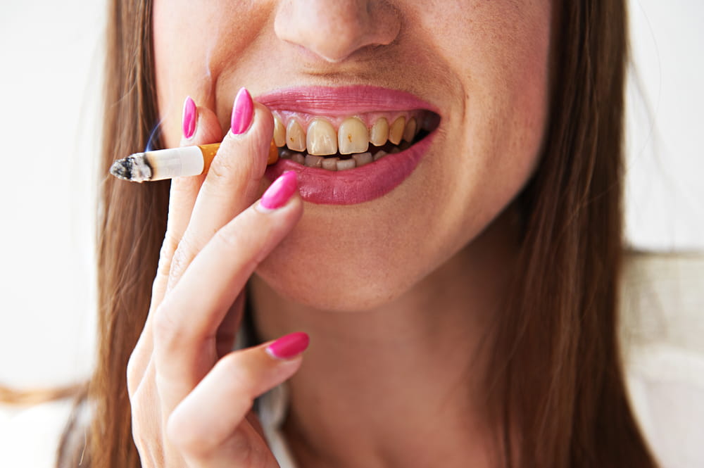 A woman with yellow teeth smoking